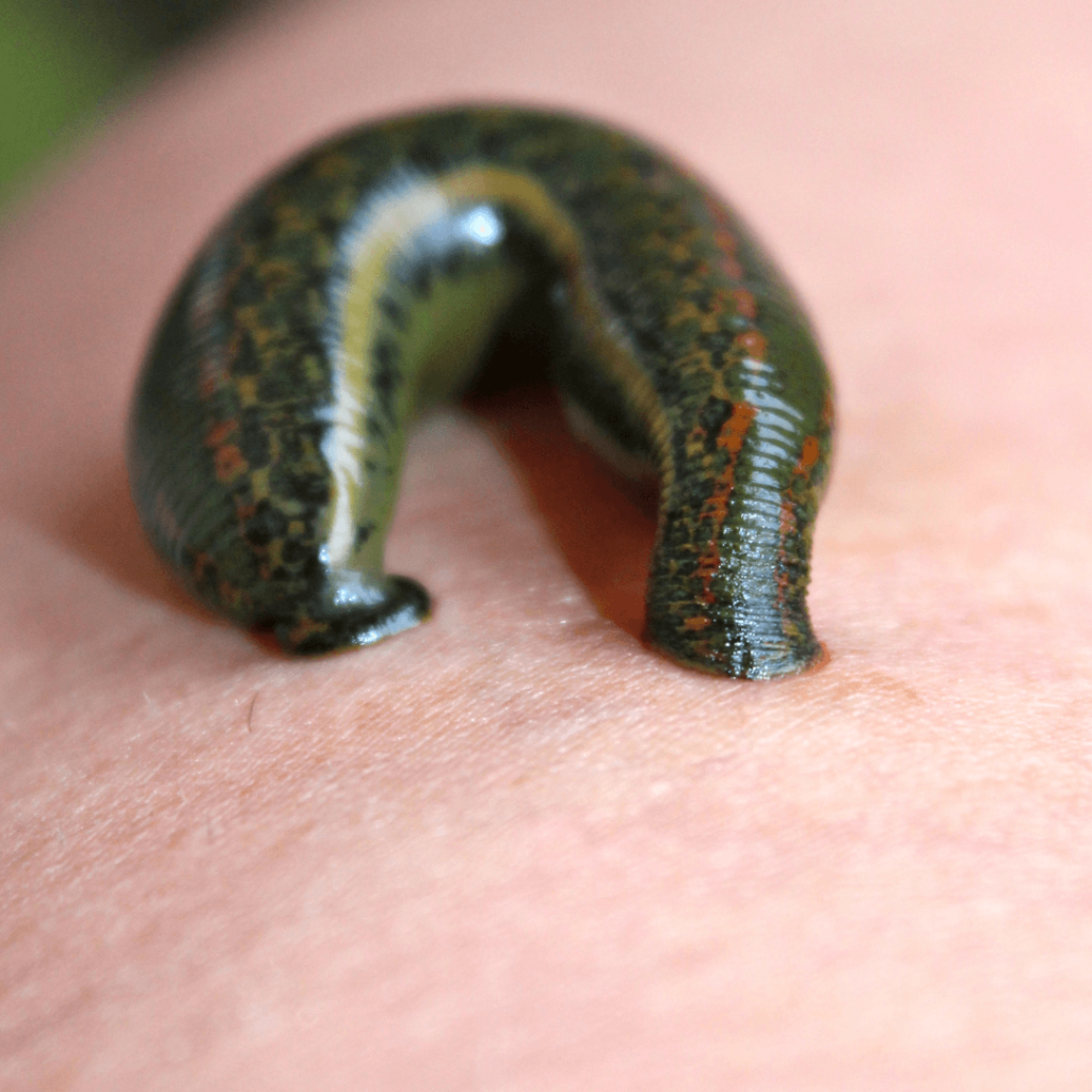 leech therapy benefits in panchkarma