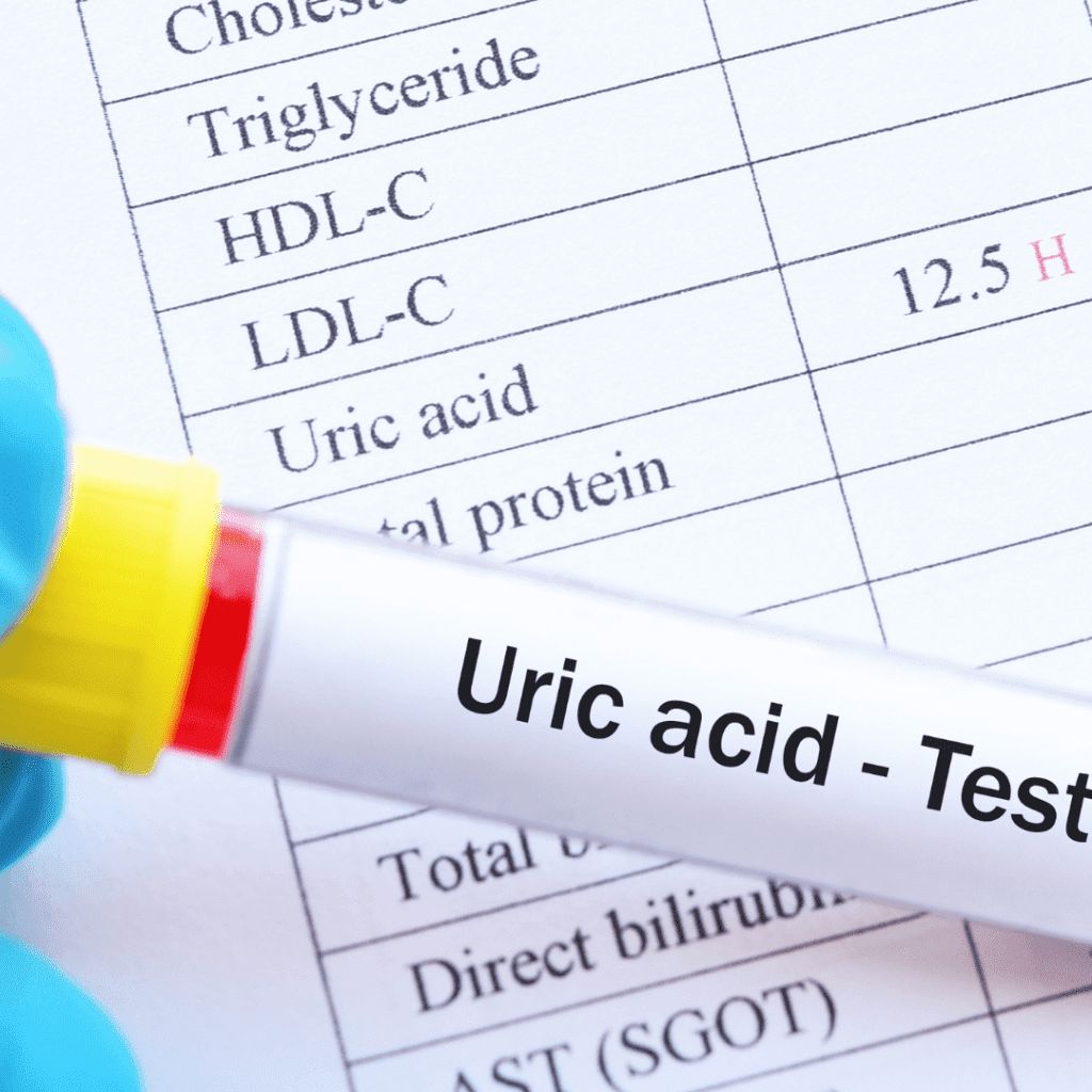 Lemon juice for uric acid