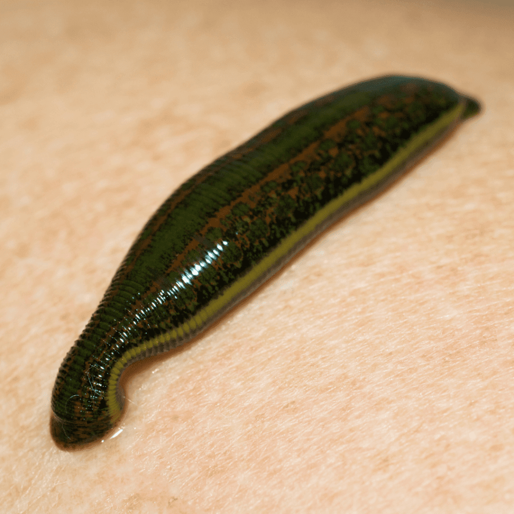 Raktamokshana treatment